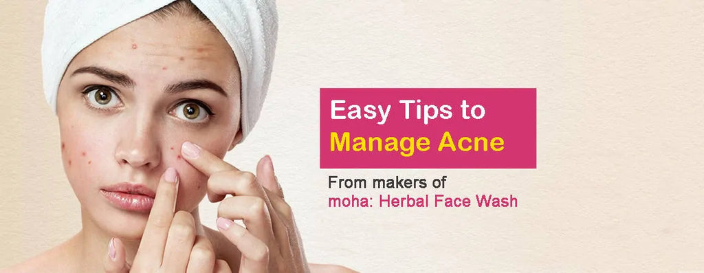 Easy Tips to Manage Acne