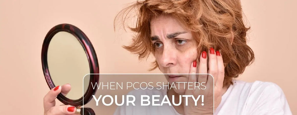 When PCOS Shatters Your Beauty!!!!