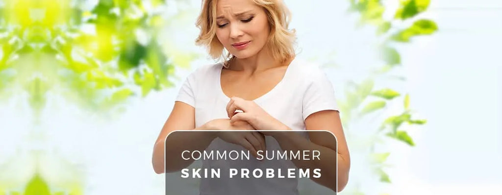 8 Common Summer Skin Problems by Charak