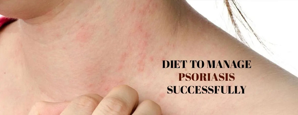 Diet to Manage Psoriasis Successfully